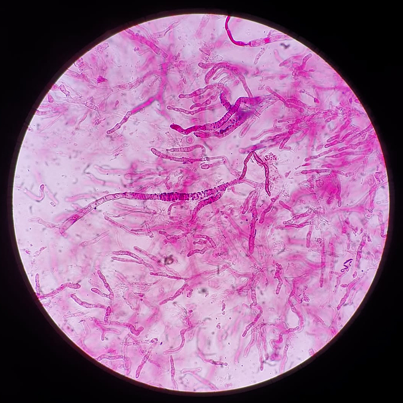 Russula amethystina hyphes